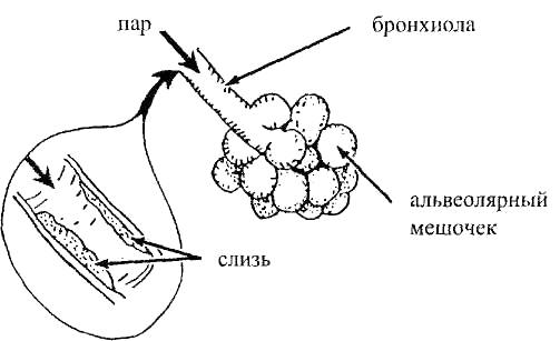 Альвеолярные мешочки легких во время ингаляции паром