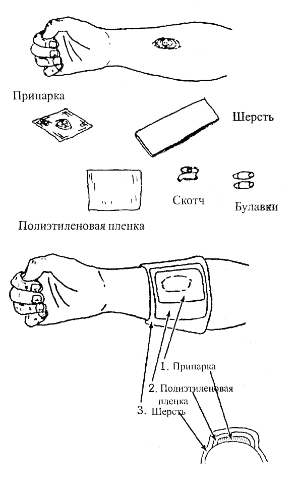 Припарка